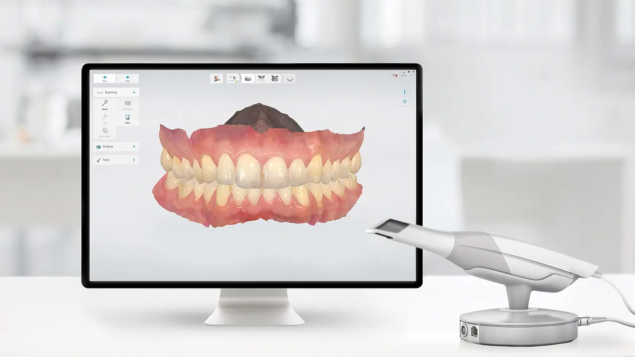 Scanner intraorale — vista 2